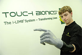 Mercedes helps kid get prosthetic limb 